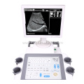 B/W Trolley Ultrasound Scanner Good Price Ultrasound Machine